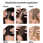 Fibres Capillaires Densifiantes  — Densi'Roots