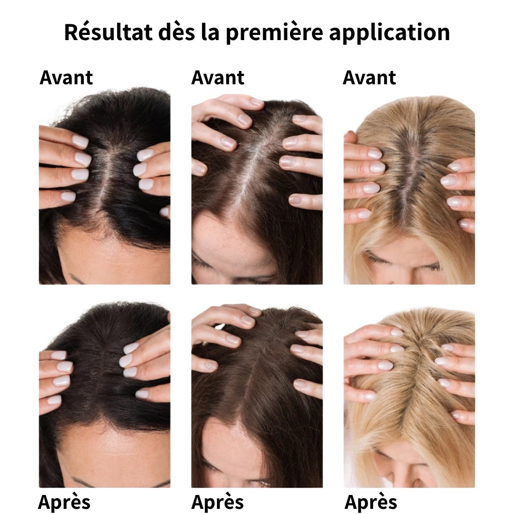 Fibres Capillaires Densifiantes  — Densi'Roots